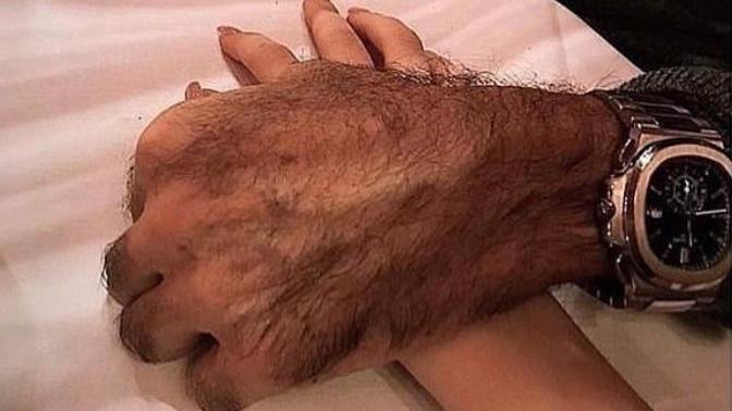 Sevgilinizin kollarının aşırı kıllı olması ondan soğumanıza neden olur mu?