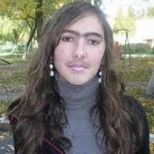 Yüzündeki tüyleri aldım, yüzüm sivilce doldu. Nasıl geçer?