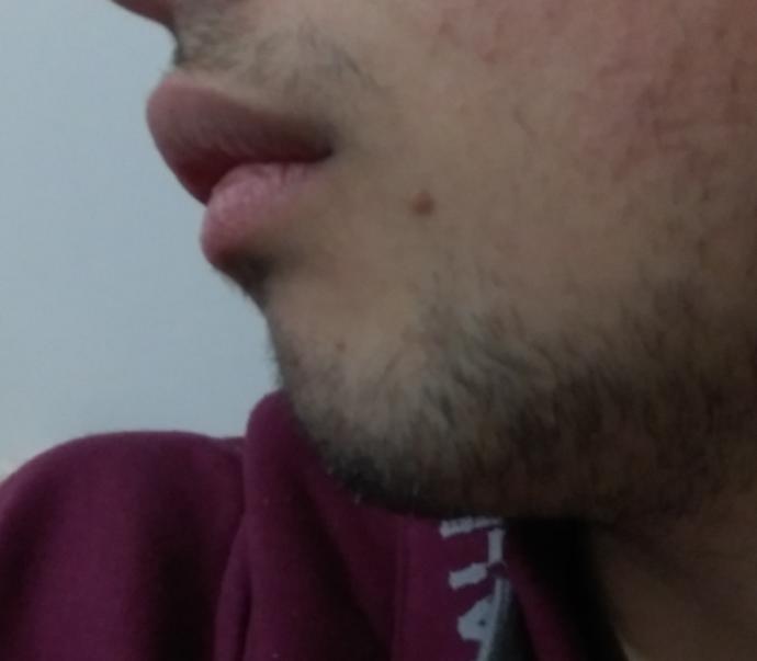 Çenem geri ne yapabilirim?