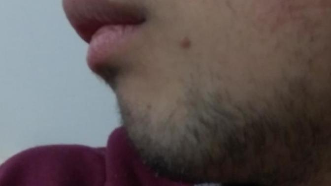 Çenem geri ne yapabilirim?