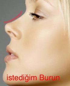 Arkadaşlar, burun ameliyatı çokmu zor, burnum güzel ama ben beğenmiyorum, kıvrımlı burunları çok beğeniyorum, ameliyata değer mi?