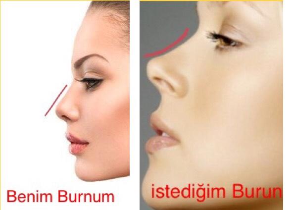 Arkadaşlar, burun ameliyatı çokmu zor, burnum güzel ama ben beğenmiyorum, kıvrımlı burunları çok beğeniyorum, ameliyata değer mi?