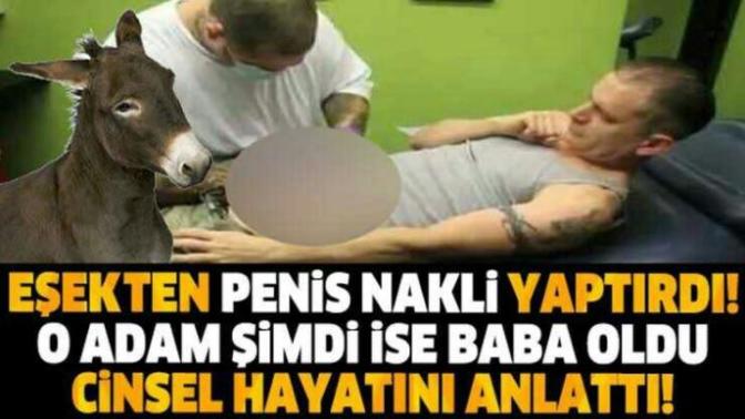 Penis nakli ile ilgili ne düşünüyorsunuz?