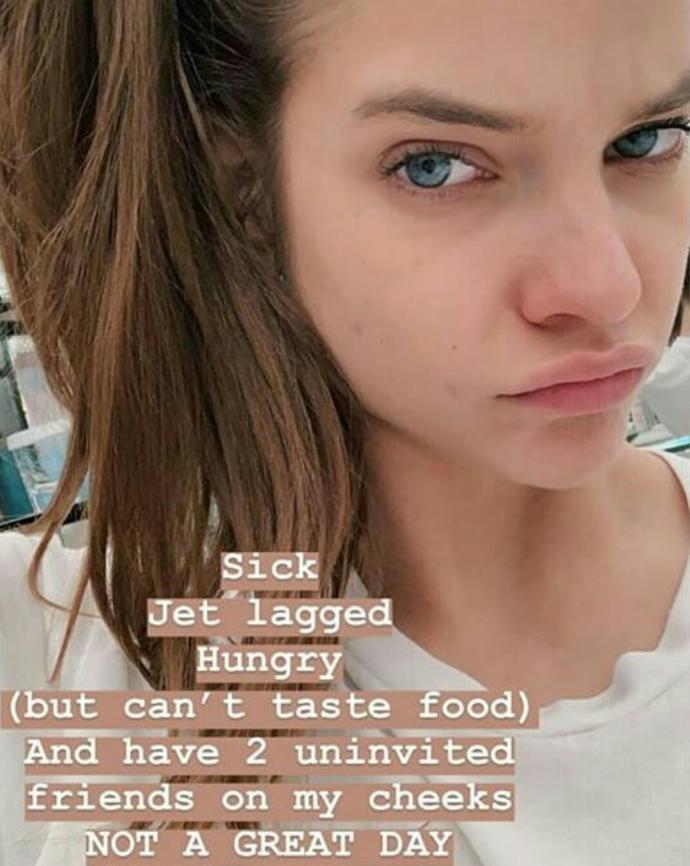 Sizde Barbara Palvin gibi olsanız, Narsisizm olur muydunuz?