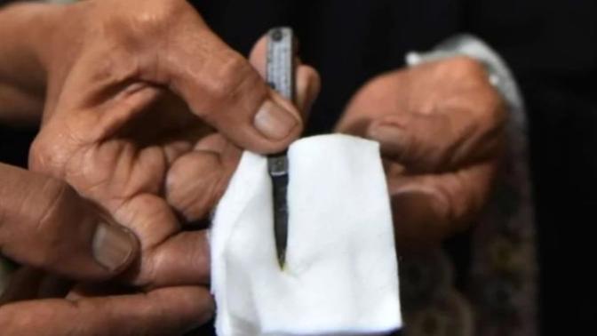 Kadın sünneti mi hayır asla inanmam? Nedir bu. ?