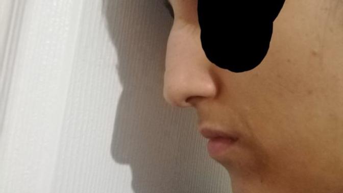 Kezbaniye ne demek? Bu burun kezban mı yapıyor bakımlı olsan bile?