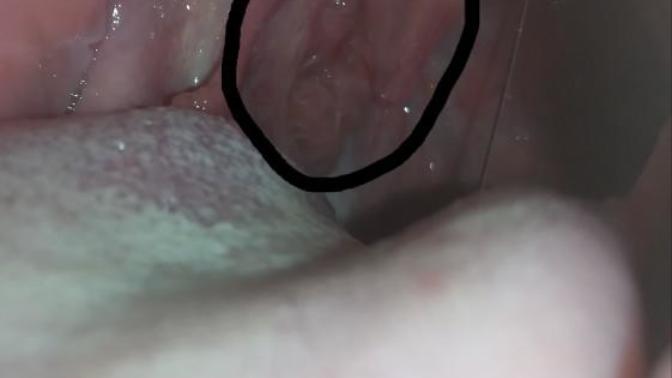 Bogazimda bir şişlik ve beyazlık var sivilce gibi bir şey var. TİKSİNENLER BAKMASIN?