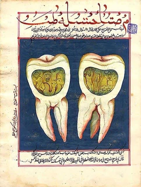Ağız kokuları ve diş çürümelerinin sebebi cin, şeytan, ifrit, iblis, azazil vb. varlıkların dişlere yerleşmesi olabilirmi?