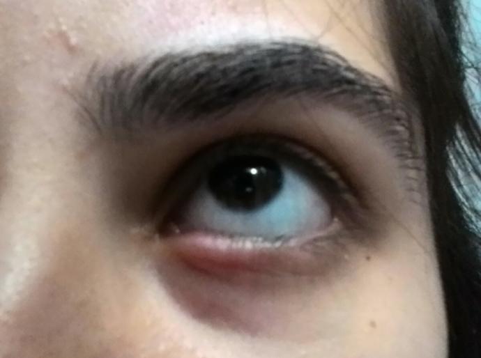Gözümden birşey çıktı ve çok açıyor?