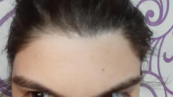 Alnım çoook küçük ve saçımdan biraz almak ve alnımı büyütmek istiyorum?