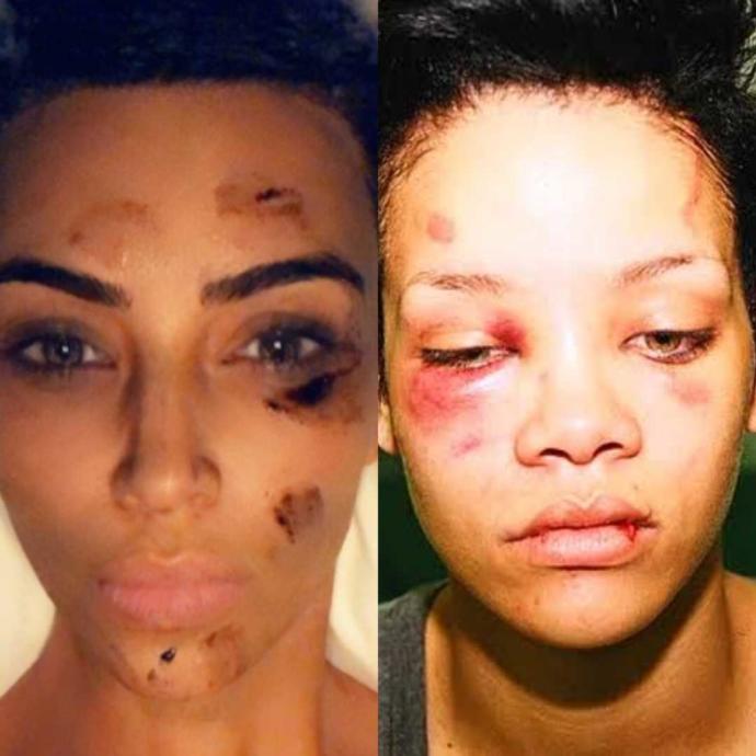 Kim Kardashian ile Rihanna yumruk yumruğa kavga etse kim döver?