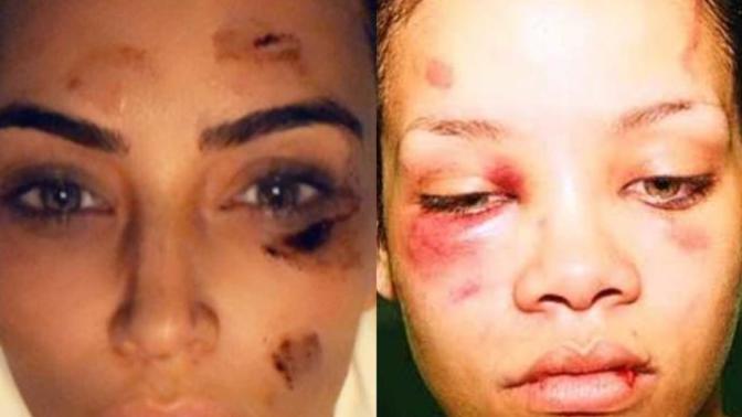 Kim Kardashian ile Rihanna yumruk yumruğa kavga etse kim döver?