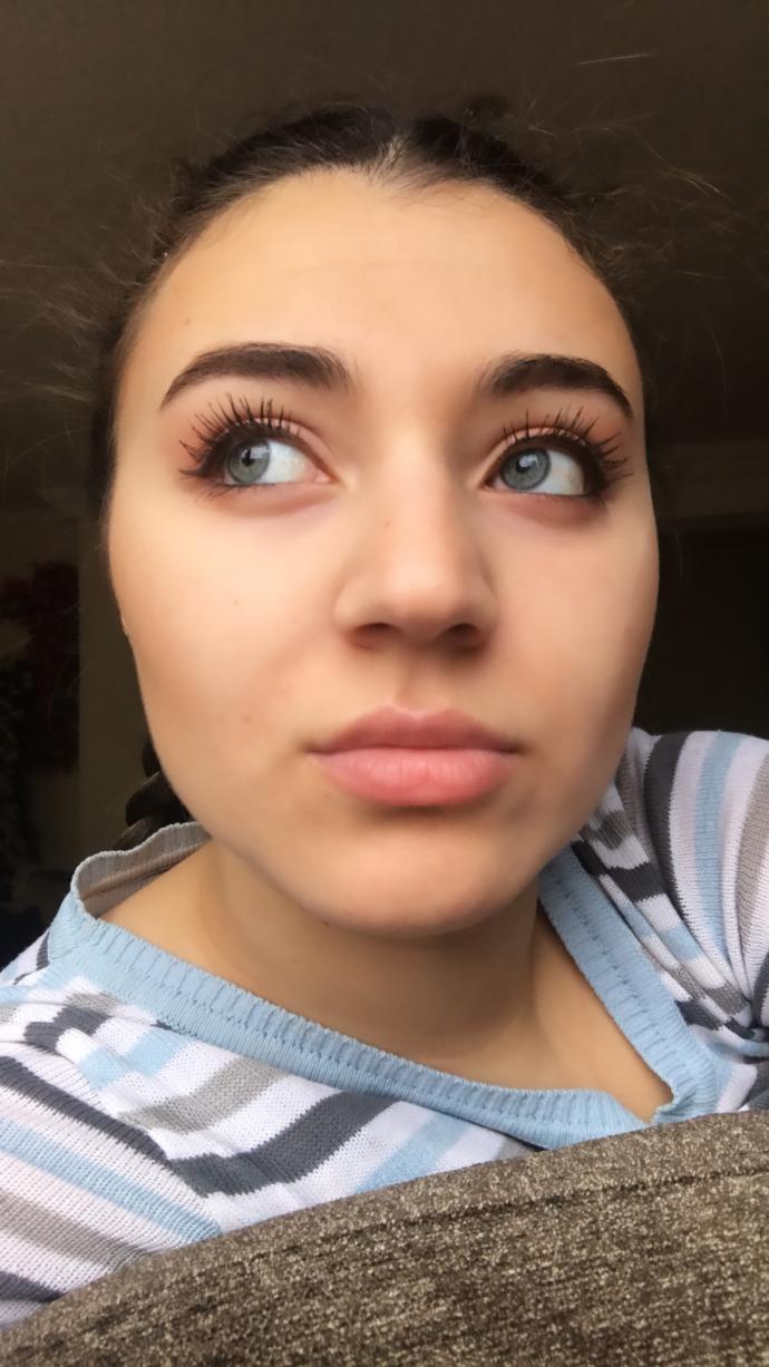 Sizce burnumu estetik yaptırmalı mıyım?