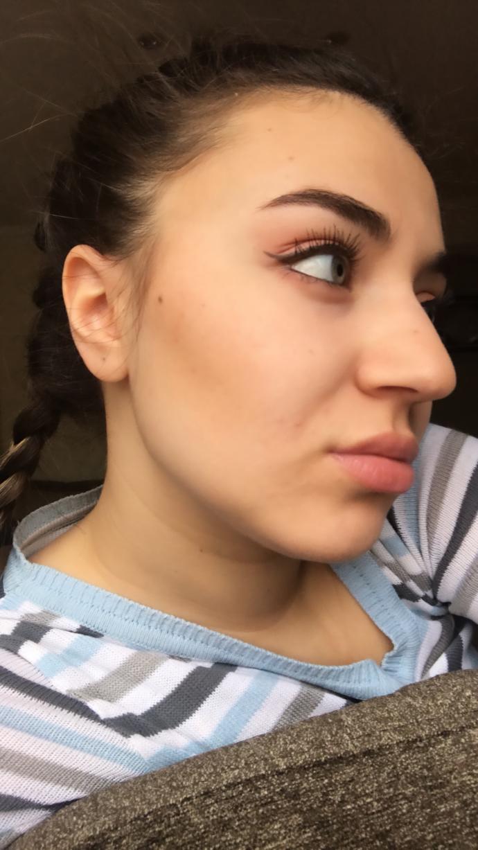 Sizce burnumu estetik yaptırmalı mıyım?