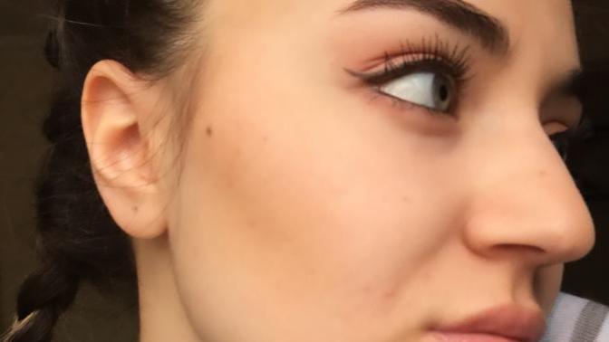 Sizce burnumu estetik yaptırmalı mıyım?
