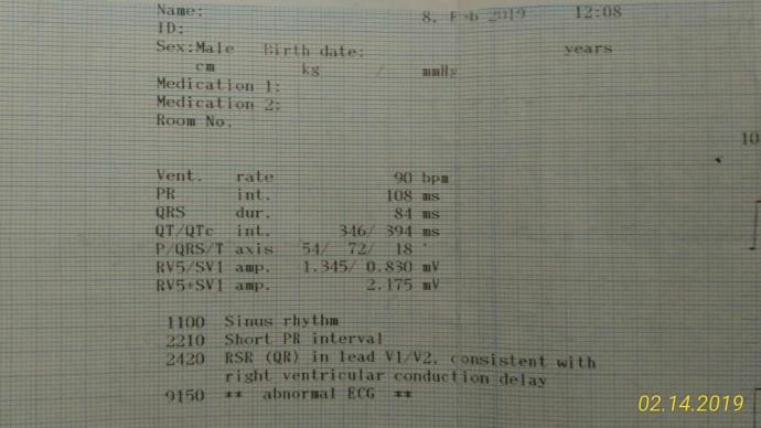 Ekg' de sıkıntı çıktı beni kardiyolojiye gönderdi doktor efor testine yolladı anlayan birisi var mı bakabilir mi sonuçlara?