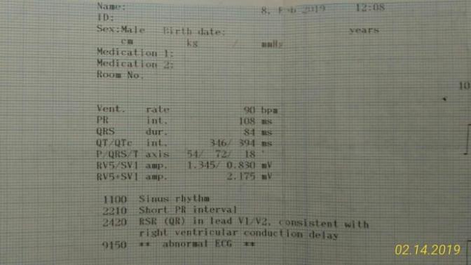 Ekg' de sıkıntı çıktı beni kardiyolojiye gönderdi doktor efor testine yolladı anlayan birisi var mı bakabilir mi sonuçlara?