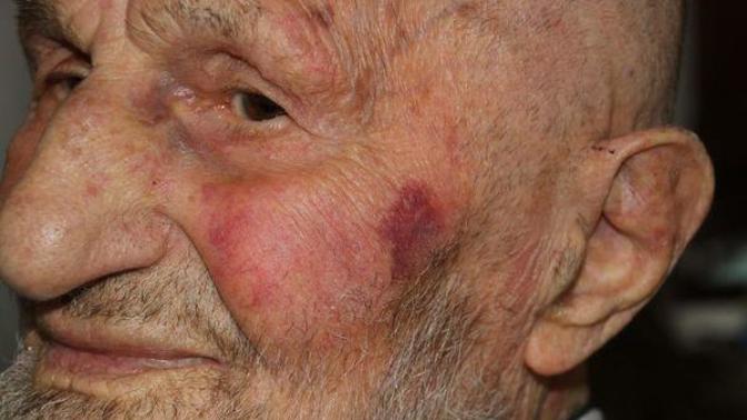 'Neden selamımı almadınız' dediği için dayak yiyen 95 yaşındaki Mustafa dede için 'utandık'. Sen yaşlılara hürmet gösterir misin?