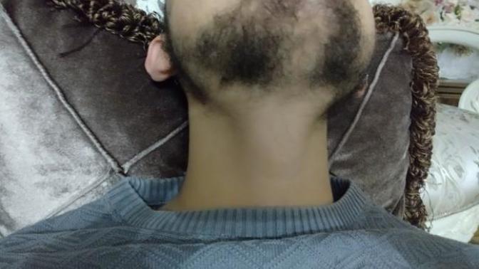 Sakallarım seyrek çıkıyor jiletin faydası olur mu?