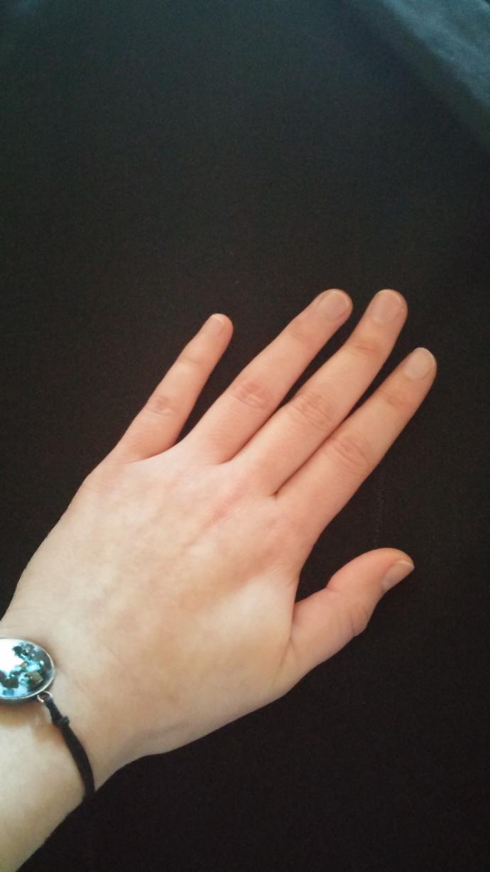 Orta parmağı yamuk olan var mı?