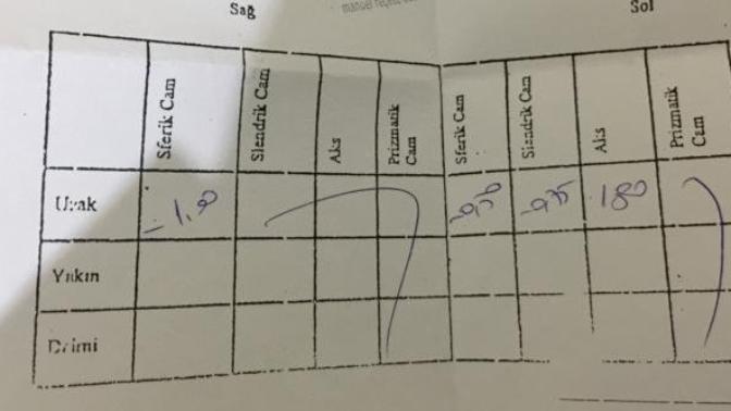 Kaç numara gözlerim şimdi ya?