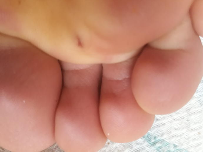 Ayagima cam battı dünden beri çok acıyor icinde cam olup olmadığını nasıl anlarım,?
