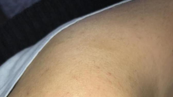 Lazere gidiyorum ama beklediğim azalmayı alamadım sizce nasıl?