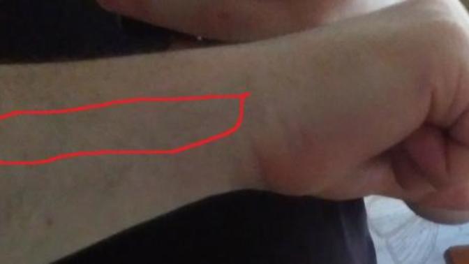 Vücut geliştirmeden anlayanlar baksın lütfen dambıl kaldırırken dış bilek acısı (resimli) ?