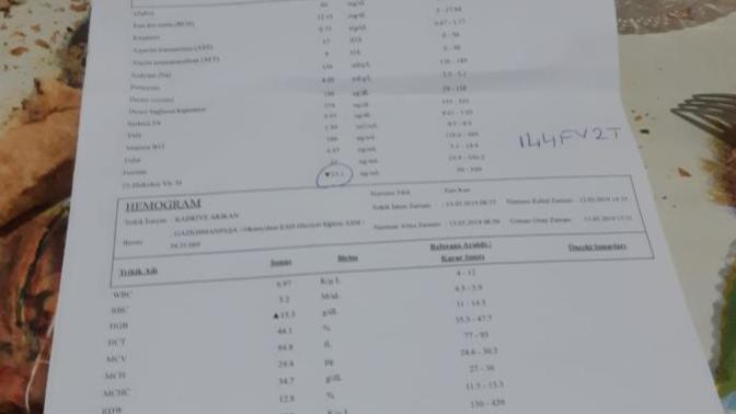 Kan tahlili sonucu yorumlarmısınız mono yüksek gözüktü doktor bişey demedi ama aklımda kaldı?