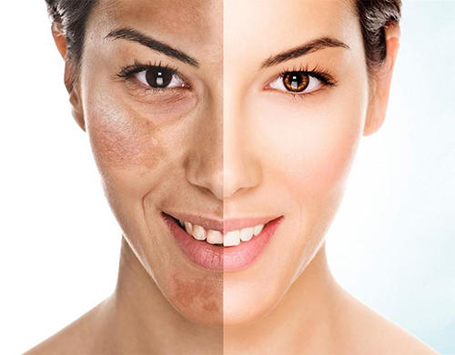 Kolajen (Collagen) Takviyesi kullanıyor musunuz?