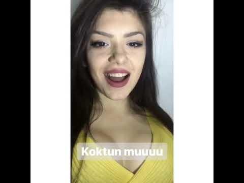 Örümcek ısırığı sonrası 20 gün geçmesine rağmen dudağım böyle kaldı 😞😞 kötü ve rahatsız edici mi duruyor?