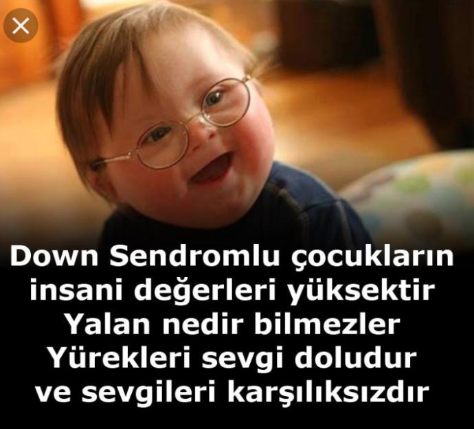 21 Mart'ın Dünya Down Sendromu Günü olduğunu biliyor musunuz?