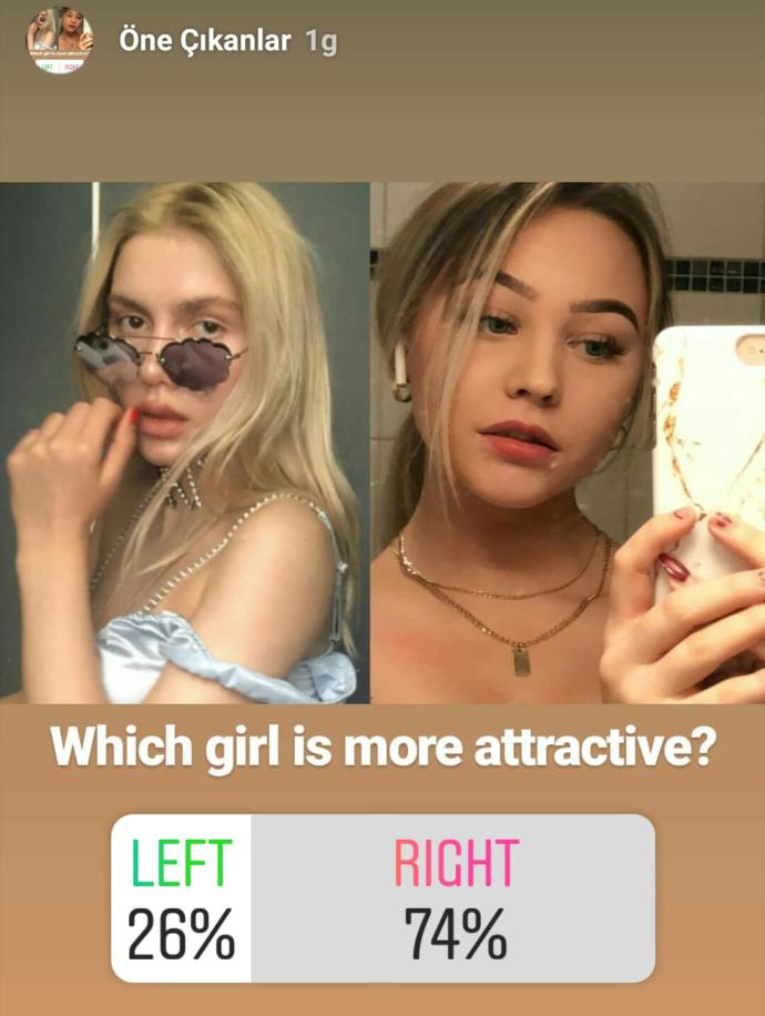 Aleyna Tilki çirkin mi, çok mu çirkin?