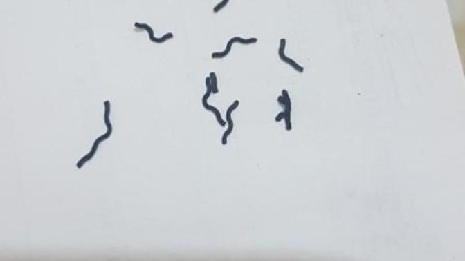 Bu ne pisliği bilwn var mi?