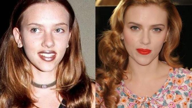 Scarlett Johansson'un estetikli olmasına niye kimse laf etmiyor?