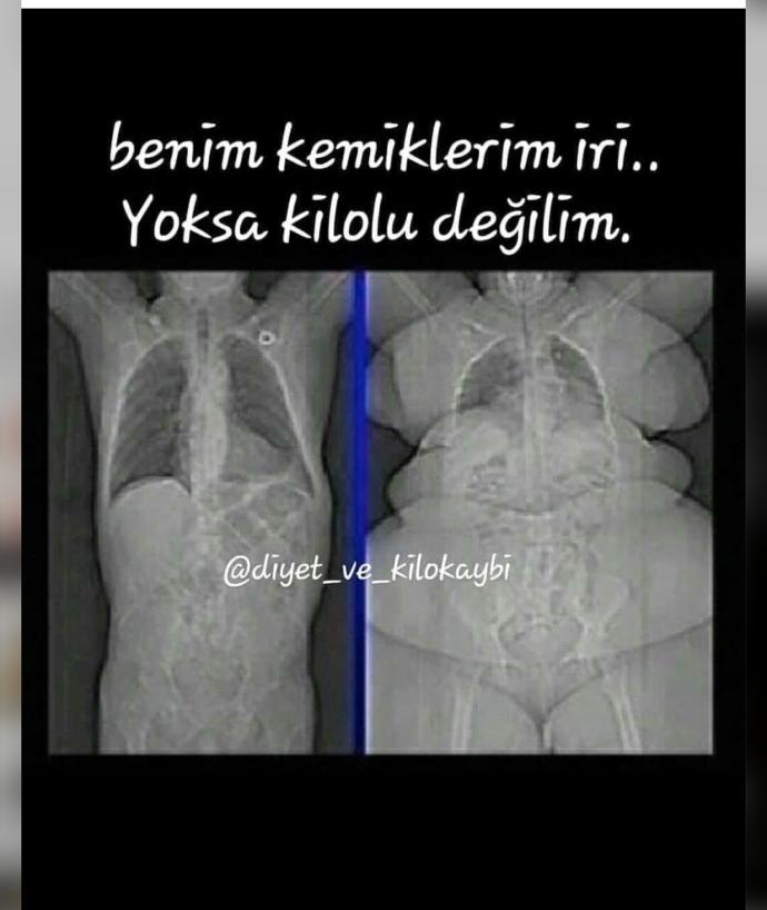 Benim kemiklerim iri midir?
