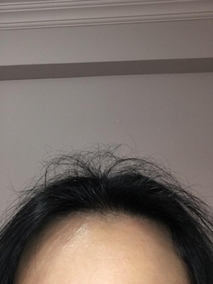 Saçlarım çok kötü önerisi olan var mı?