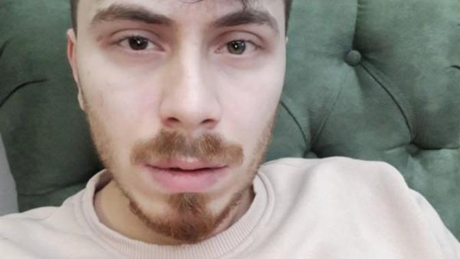 Aranız'da Heterokromi hastası varmı?