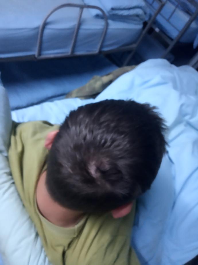 Arkadaslar sacim tepe kismindan dokulmeyemi baslamis lutfen anlayan kisiler yorumda bulunsun sizce bu sac ayrimi mi?
