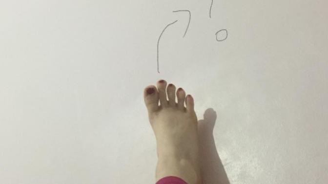 Ayak parmağı böyle olan var mı?