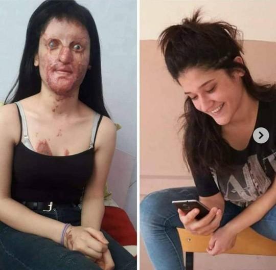 Berfin'in durumunu yaşadığı şeyi bilmeyen hala var mı?