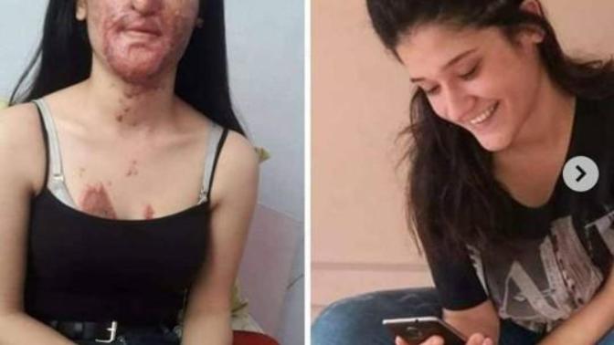 Berfin'in durumunu yaşadığı şeyi bilmeyen hala var mı?