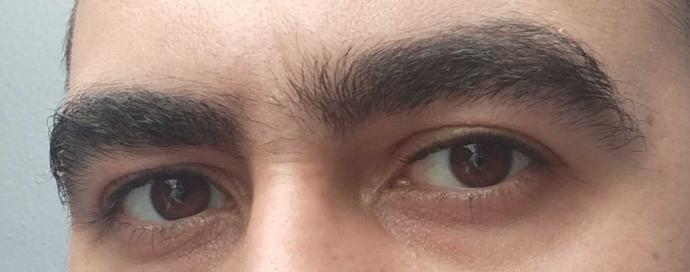 Kusur sayılan ama bazı insanlara yakışan, fiziksel özellikler nelerdir?