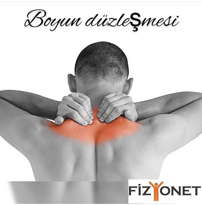 Boyun düzleşmesi nedir?
