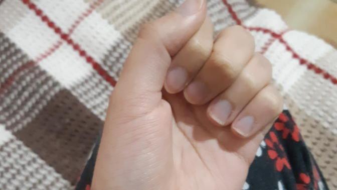 Ellerim neden morarıyor?