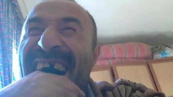 Sevgilinizin gülerken eksik dişinin görülmesi sizce sorun mu?