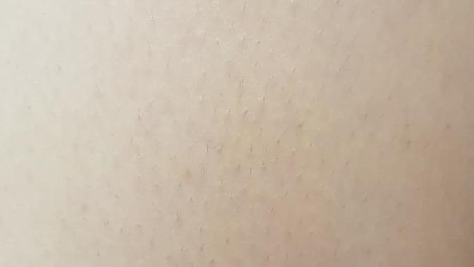 Lazer epilasyon deneyimi olan arkadaşlar lütfen bakar mısınız?