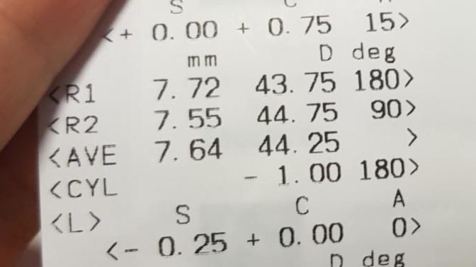Bu göz ölçümü sonuçları nedir?