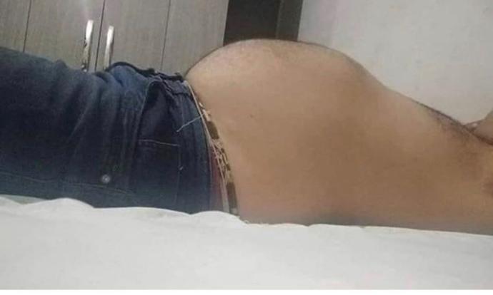 İftardan sonra sizde de şişkinlik oluyor mu?