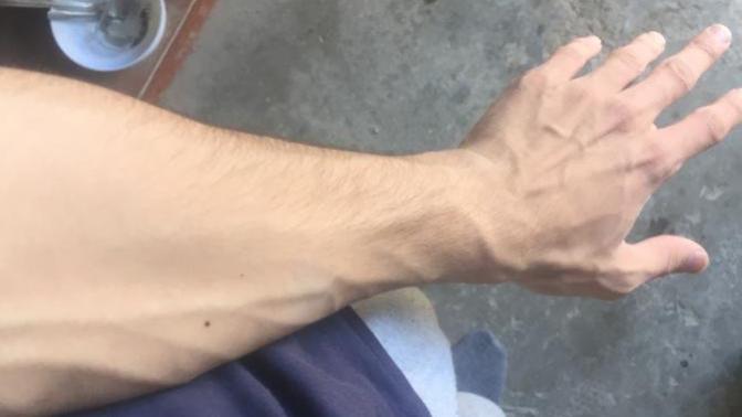 Dövme yaptırmak istiyorum kolum ince olur mu?